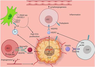 Inflammation and Progression of Cholangiocarcinoma: Role of Angiogenic and Lymphangiogenic Mechanisms